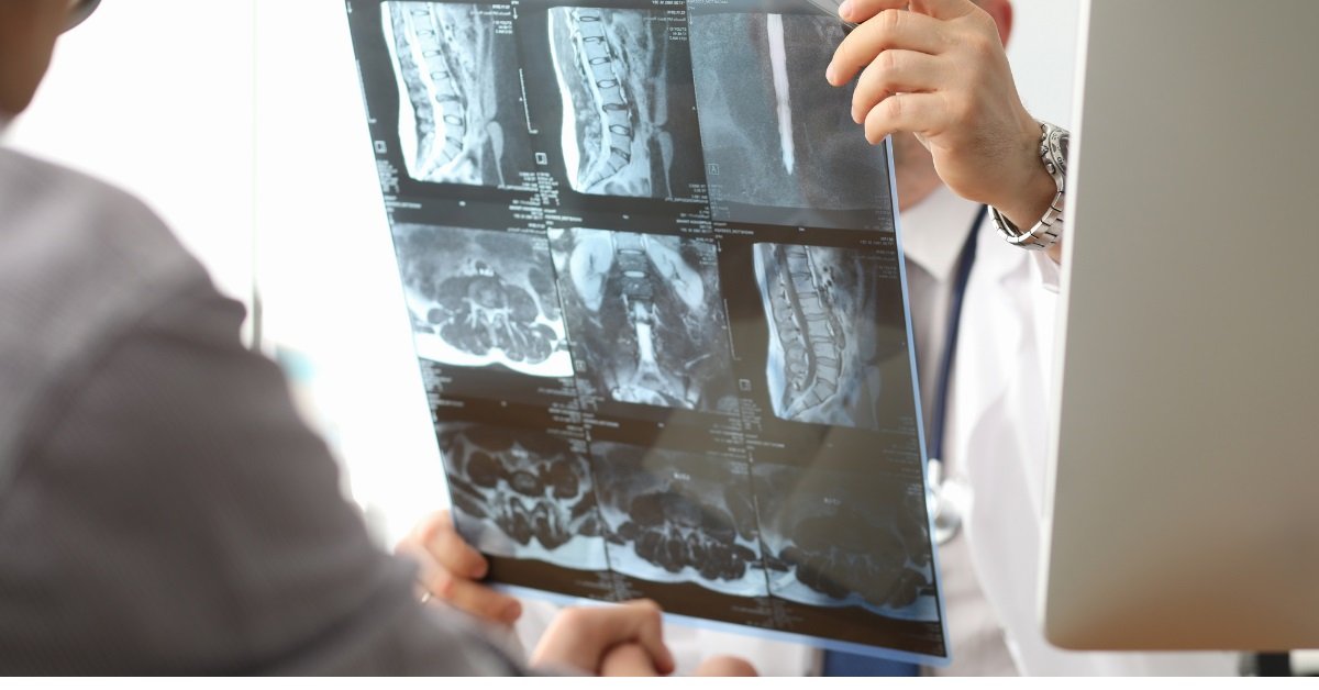 spinal cord injury - urbanlymodern